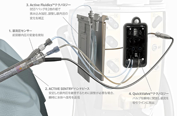 超音波白内障手術機械　Active FluidicsTMテクノロジーwith ACTIVE SENTRY®